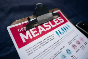 Health officials raise alarm after second measles case on Long Island, potentially linked to a restaurant.