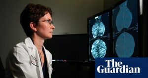 Innovative genetic test may save millions of breast cancer patients from chemotherapy