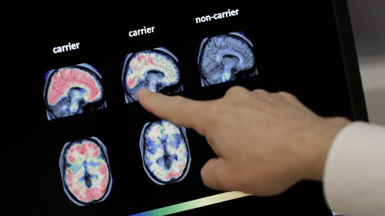 It’s likely already in your refrigerator, and it may help reduce the risk of Alzheimer’s.