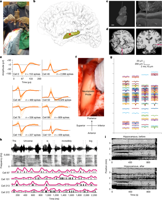 Language and adaptability in the unconscious human hippocampus