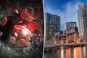 Long Island faces significant challenges with a common blood condition, according to research.
