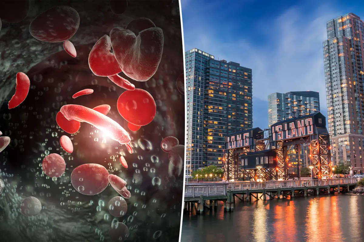 Long Island faces significant challenges with a common blood condition, according to research.