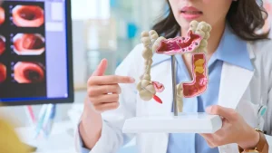 New colorectal cancer screening guidelines issued by the American Cancer Society