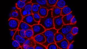 New pill offers promising hope for lethal pancreatic cancer