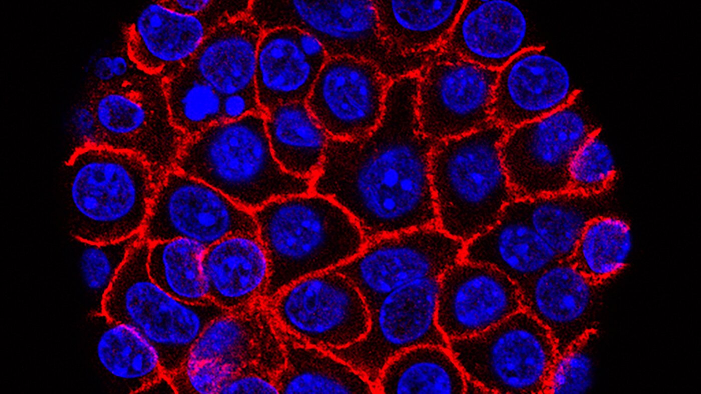 New pill offers promising hope for lethal pancreatic cancer