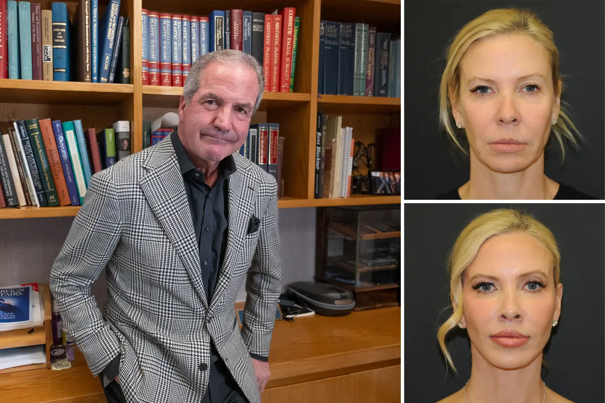 Plastic surgeon in New York City performed surgery on his whole family, including breast enhancement for his sister.