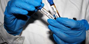 Research on hantaviruses? Yes, but the fear of the virus is still greatly exaggerated.
