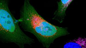 Researchers Find More Than 1,700 'Dark' Proteins Concealed in Human Cells
