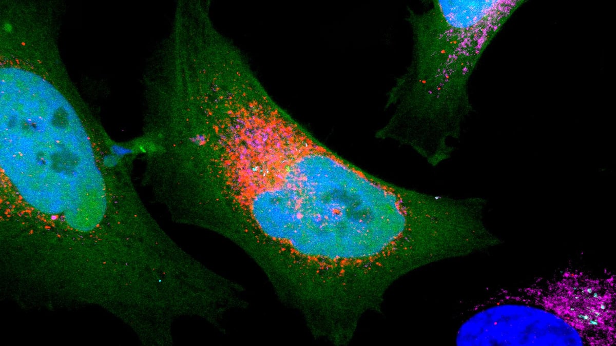 Researchers Find More Than 1,700 'Dark' Proteins Concealed in Human Cells