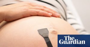 Researchers develop wearable ultrasound for constant monitoring of babies in the womb