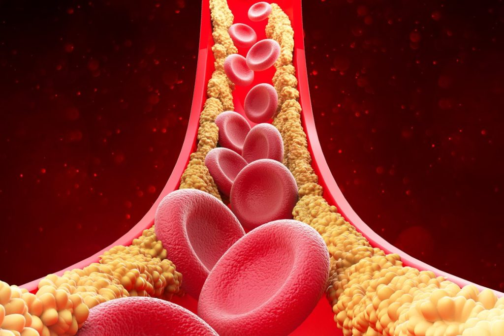 Researchers have discovered a new kind of cholesterol, which may be the most harmful.