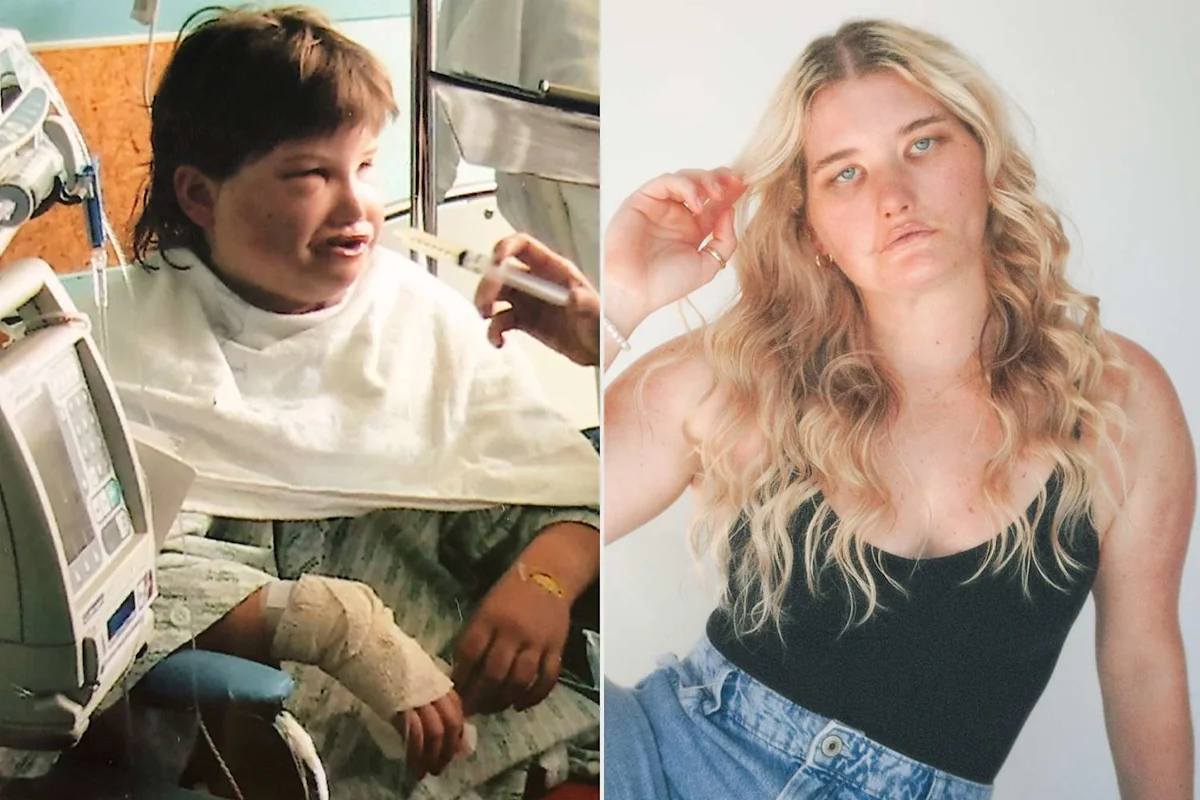 She Had 'Smile Surgery' at 11. After Seeing the Results in the Mirror, She Felt 'Broken'
