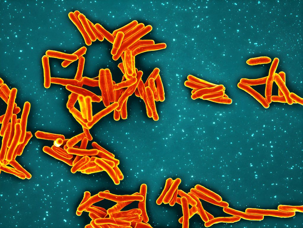 Significant outbreak: Almost 20% impacted by TB at San Francisco school