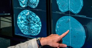 When is the best time to schedule a mammogram? Mixed messages create confusion.