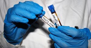 Your Hantavirus Questions Addressed by a Disease Specialist