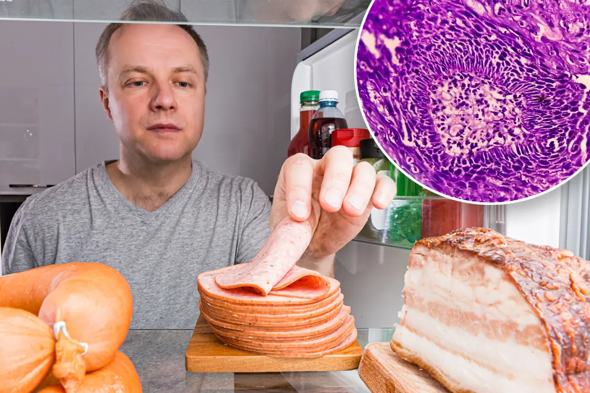 An additional daily serving of processed meat associated with increased cancer risk