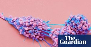 Approval granted for life-extending medication for advanced ovarian cancer in England