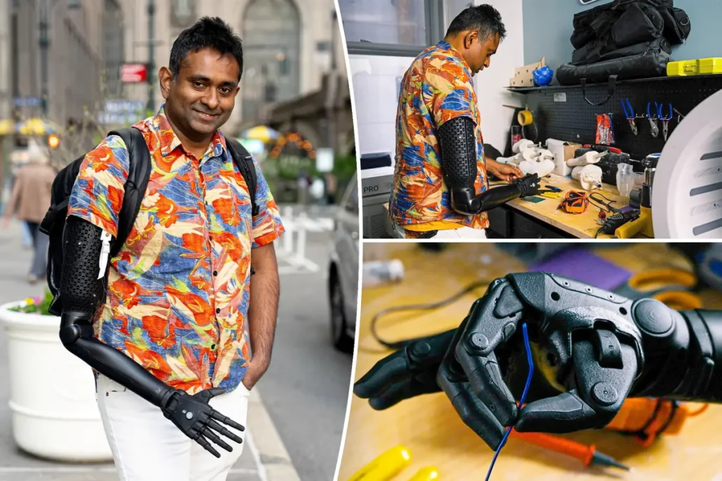Bronx scientist becomes the first to get a 3D-printed robotic arm