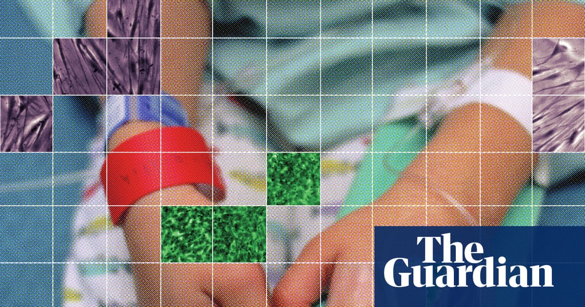 Children with autism receive unapproved stem cell therapies backed by RFK Jr.