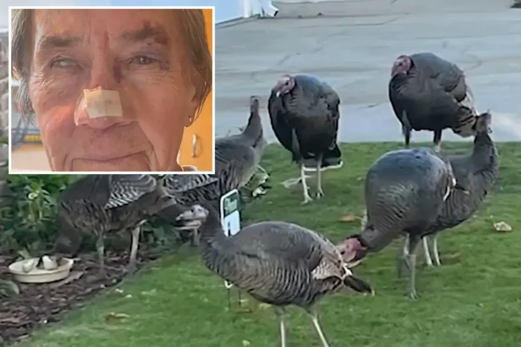 Elderly woman, 83, injured in wild turkey incident requiring six stitches