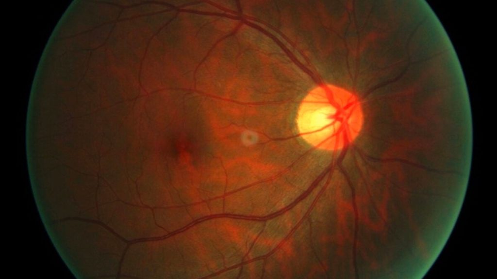 First Person Undergoes New Treatment to Reverse Cell Aging