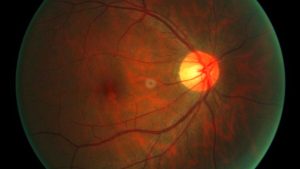 First Person Undergoes New Treatment to Reverse Cell Aging