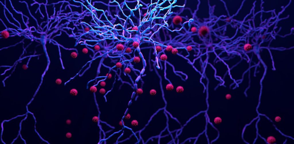 HIV reaches the brain and stays there &ndash; surprisingly, medications meant to lessen brain inflammation raise the virus levels.