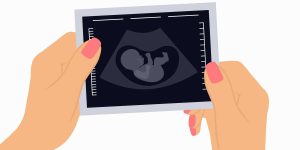 Healthcare is set to increase the costs of pregnancy.