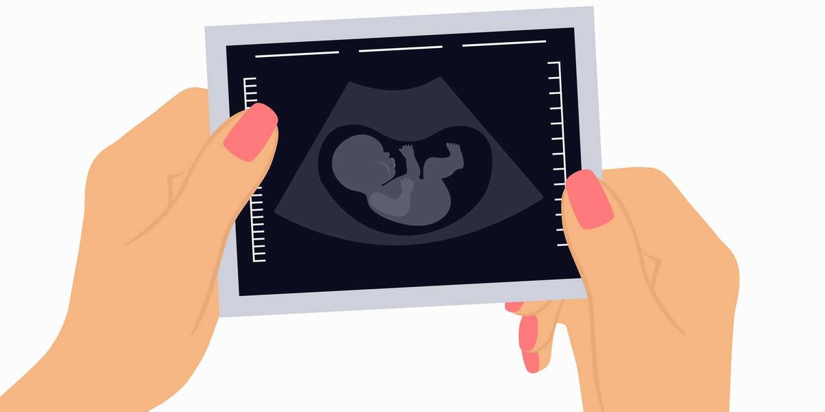 Healthcare is set to increase the costs of pregnancy.