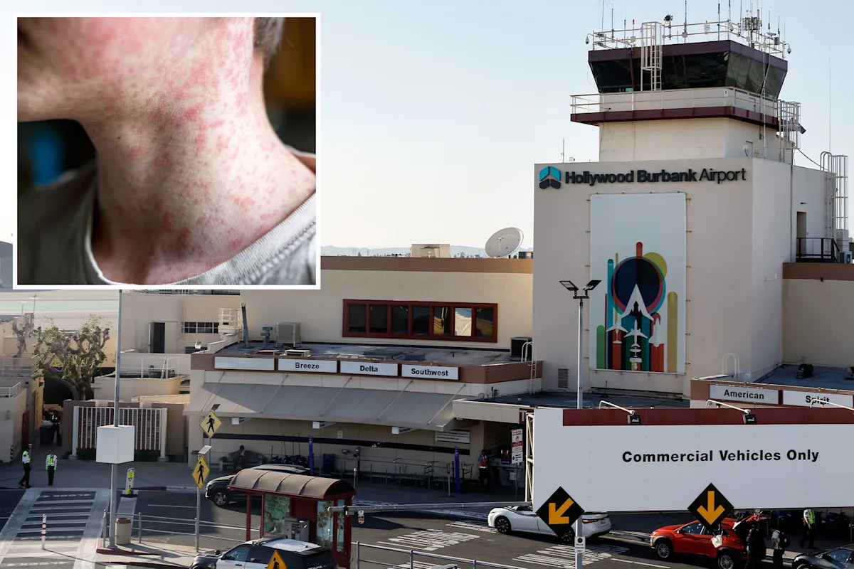 Highly contagious disease discovered at crowded California airport