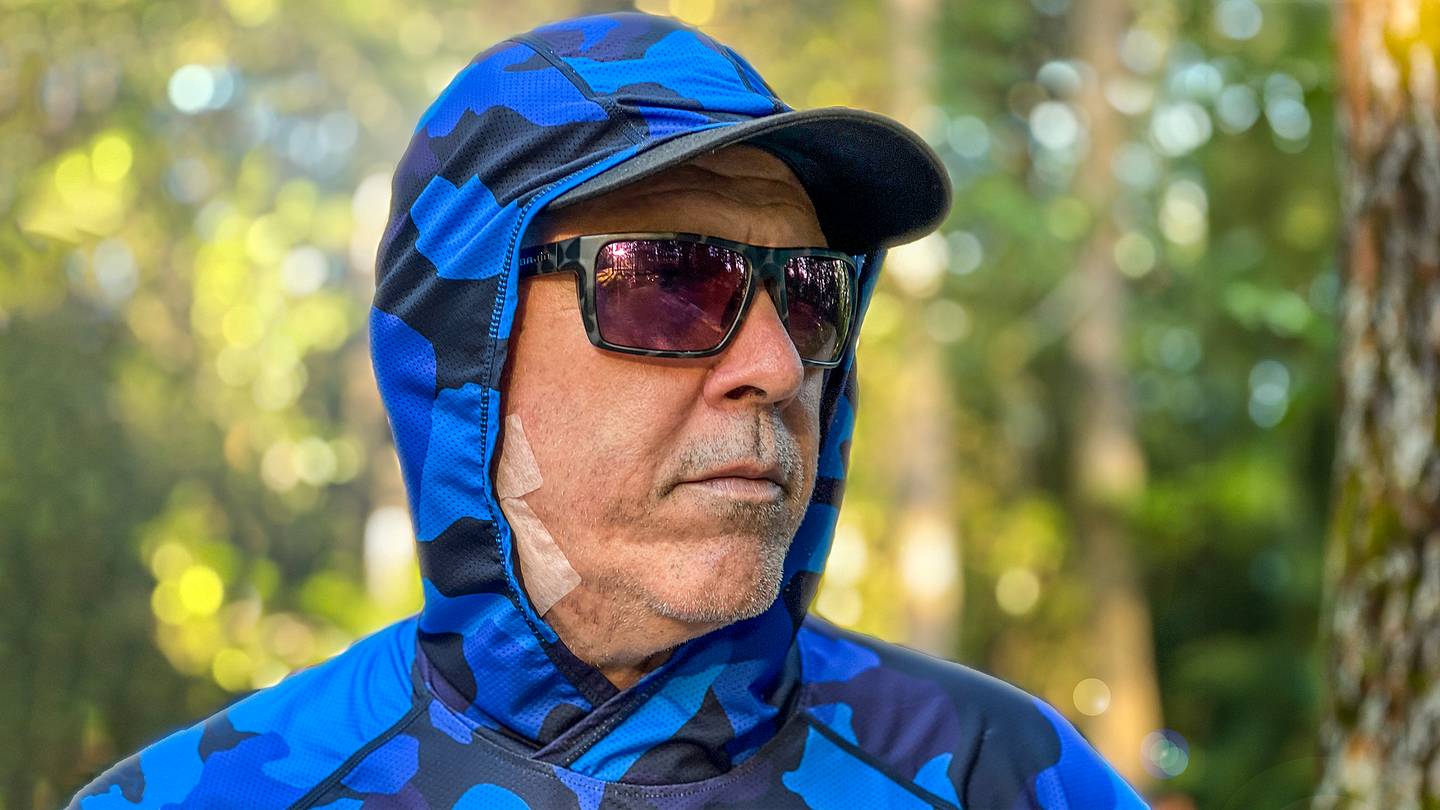 I Believed I Was Taking Sun Protection Seriously. It Turned Out It Was Already Too Late.