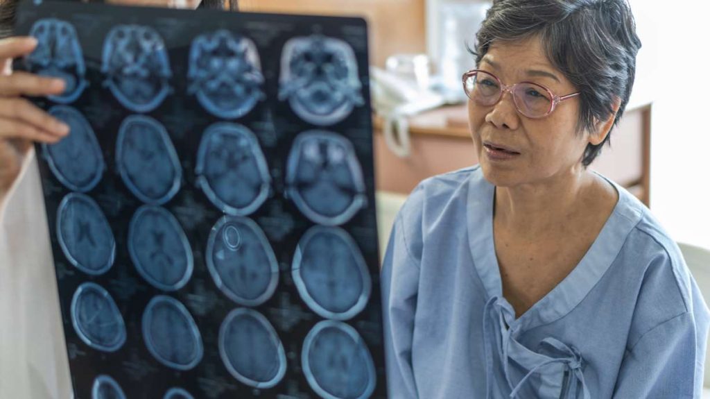 Identifying stroke symptoms and responding quickly