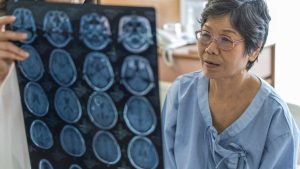 Identifying stroke symptoms and responding quickly