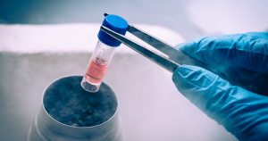 In October 2024, researchers from Peking University announced that a 25-year-old woman with Type 1 diabetes since childhood no longer required insulin injections just 75 days after undergoing an experimental stem cell transplant using her own fat cells.
