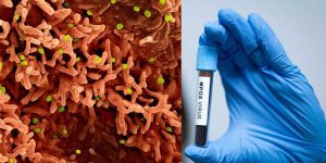 International 'Fauci associate' and his African partner accused of bringing monkeypox into the U.S.