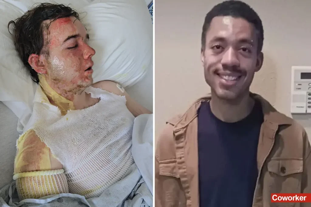 McDonald's manager in California shares his experience after being splashed with oil by a colleague