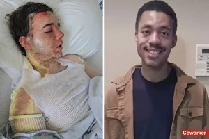McDonald's manager in California shares his experience after being splashed with oil by a colleague