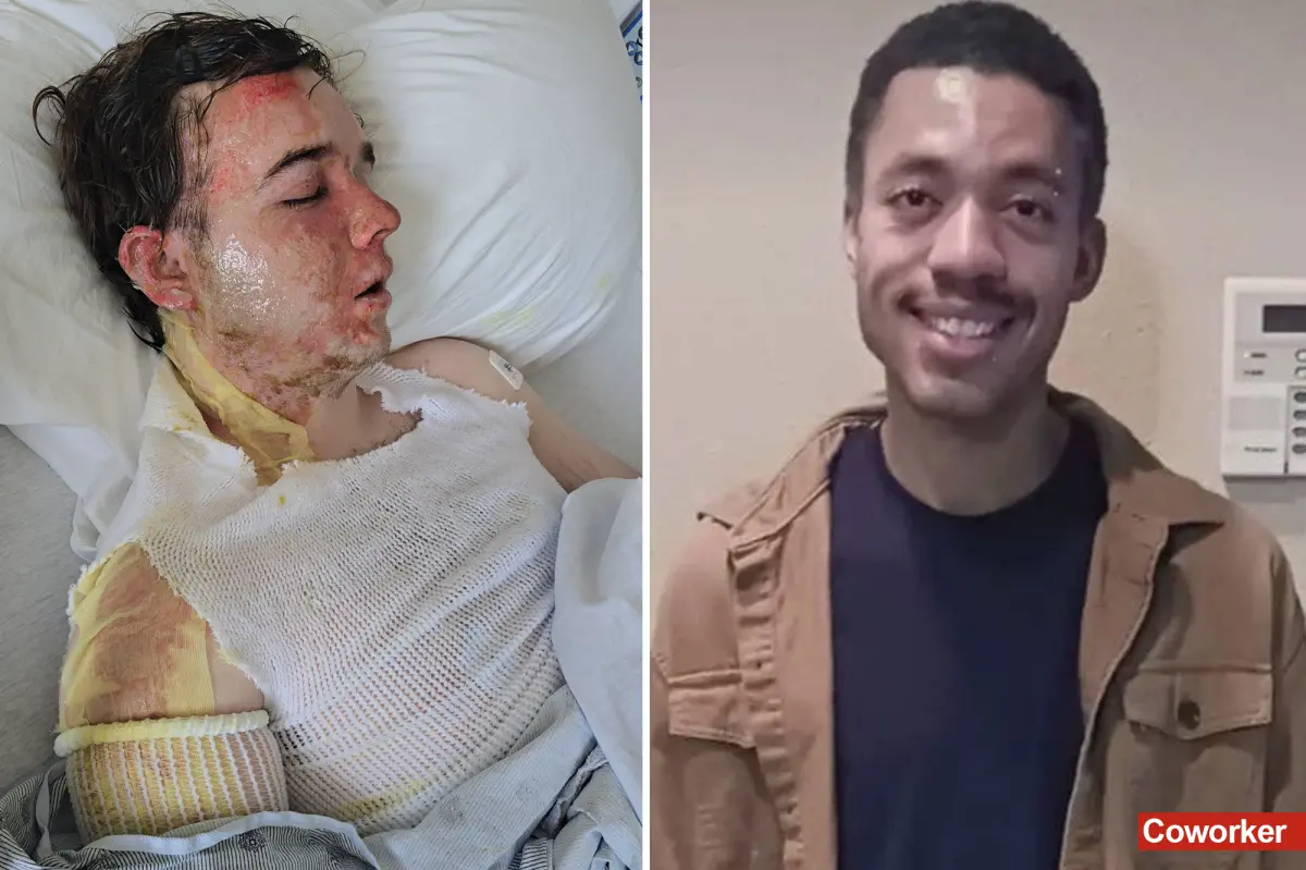 McDonald's manager in California shares his experience after being splashed with oil by a colleague