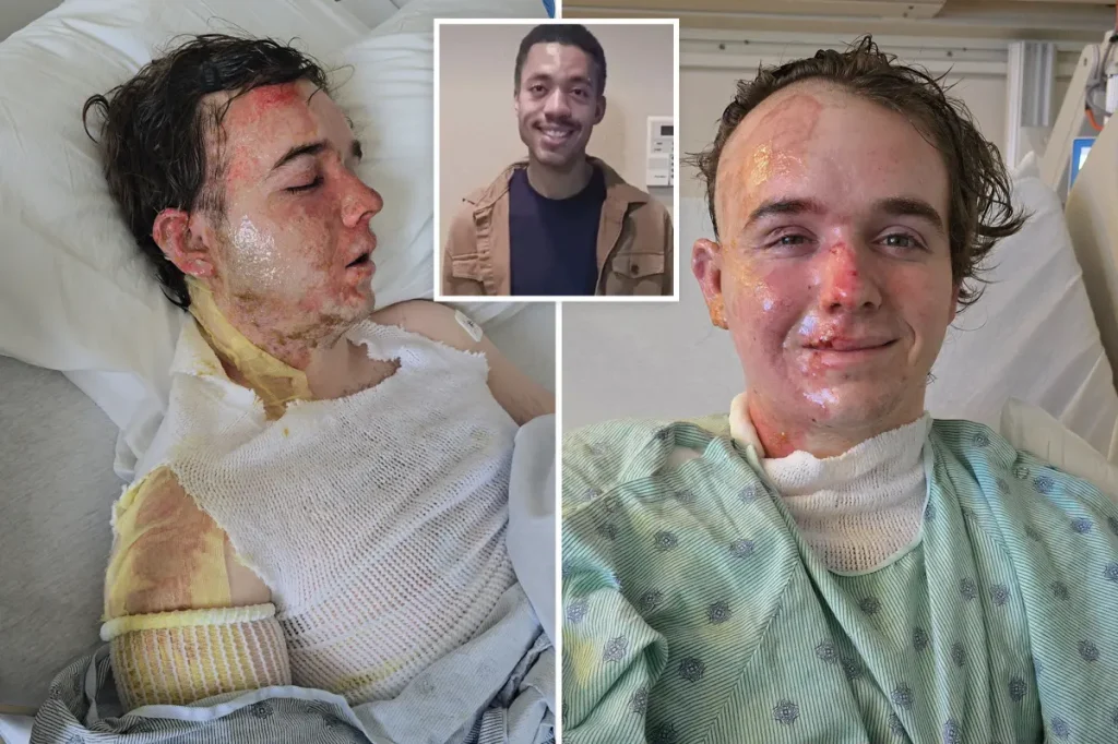 McDonald's worker in critical condition after coworker reportedly splashed hot oil on him