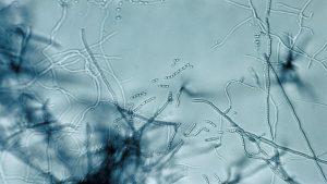New Antibiotic Discovered in Soil Fights Superbugs in an Unprecedented Manner