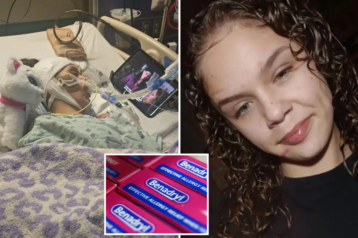 Oklahoma girl left brain dead from 'Benadryl Challenge'