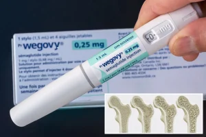 Ozempic and Wegovy may boost bone strength in patients with Type 2 diabetes, research indicates
