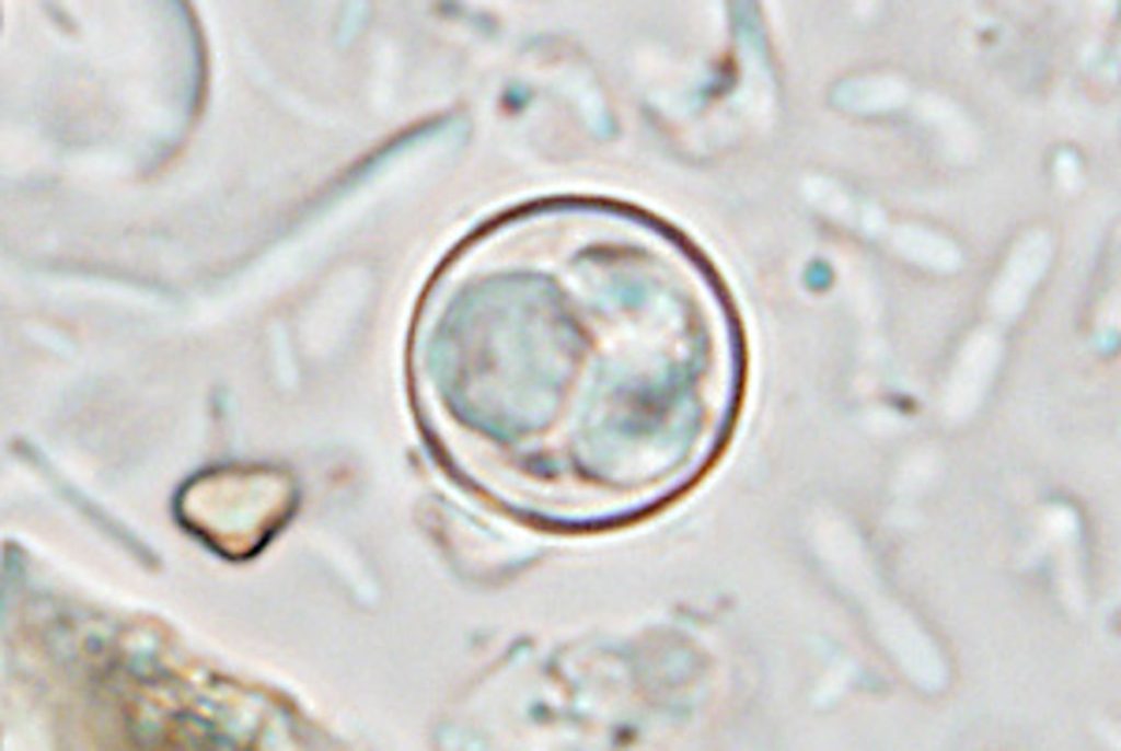 Parasite responsible for severe diarrhea is spreading throughout the US