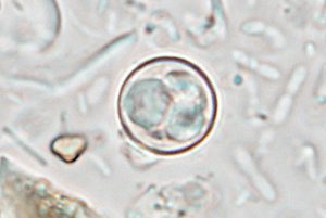 Parasite responsible for severe diarrhea is spreading throughout the US