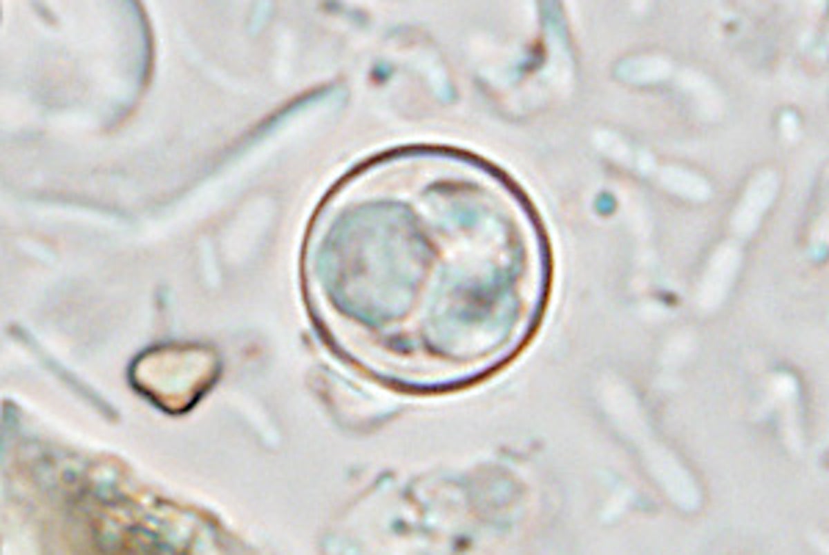 Parasite responsible for severe diarrhea is spreading throughout the US