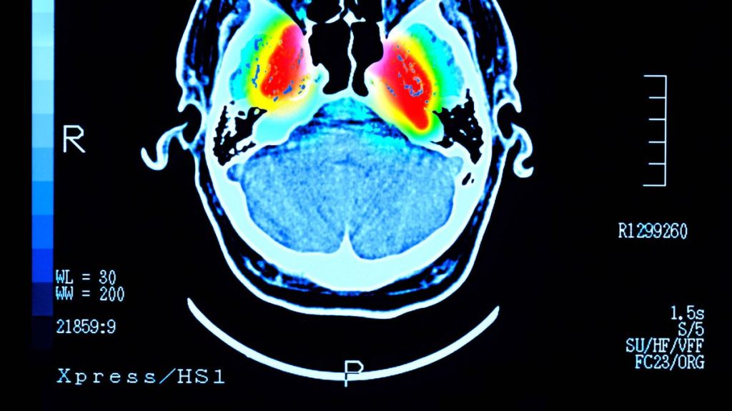 Regular 'youth-enhancing' beverage may reduce the risk of dementia and diabetes
