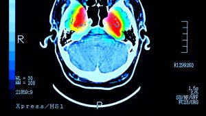Regular 'youth-enhancing' beverage may reduce the risk of dementia and diabetes