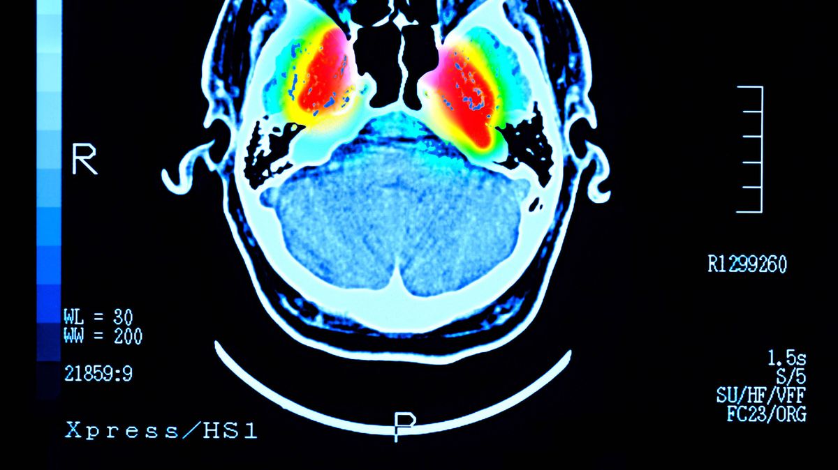 Regular 'youth-enhancing' beverage may reduce the risk of dementia and diabetes