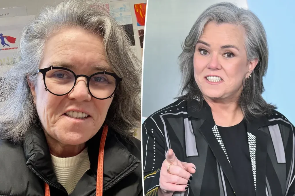 Rosie O'Donnell shares her decision about future plastic surgery following her facelift.