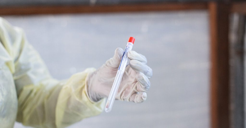 Scientist Accused of Planning to Smuggle Mpox Virus into the U.S.